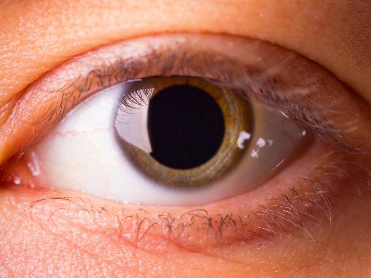 High Eyes – How Drugs Affect the Pupil Size | Prosperity Haven